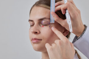 É melhor fazer blefaroplastia com cirurgião plástico ou oftalmologista?