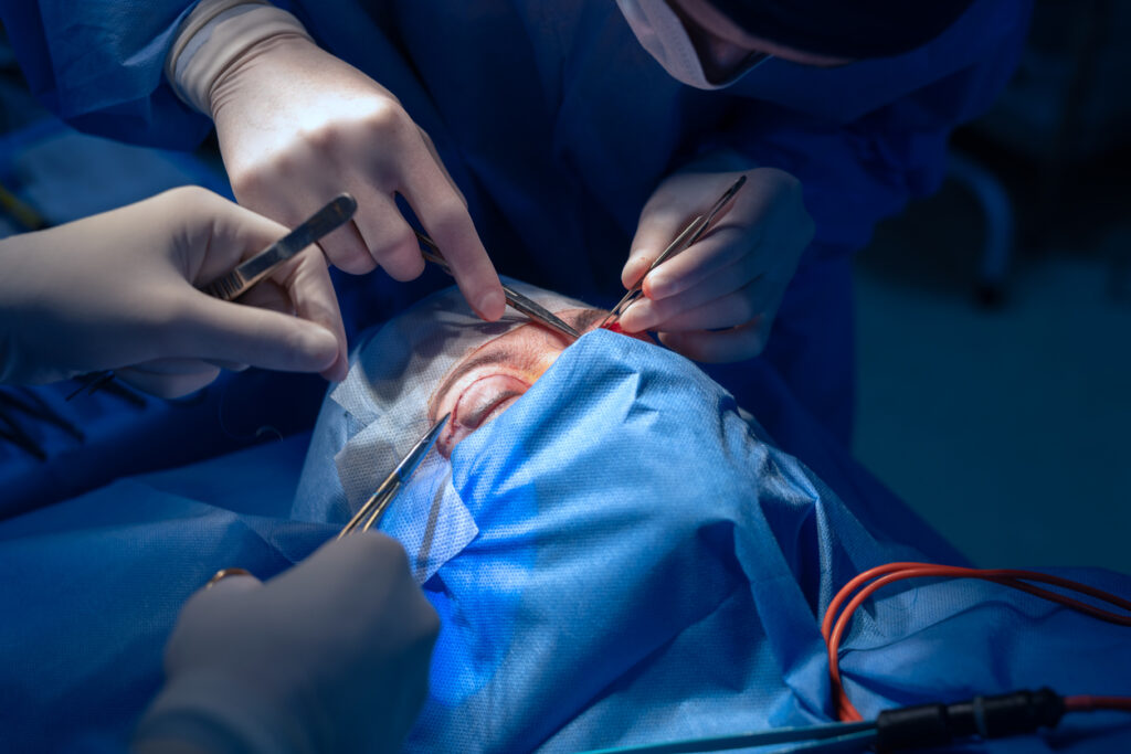 quando tirar os pontos da blefaroplastia