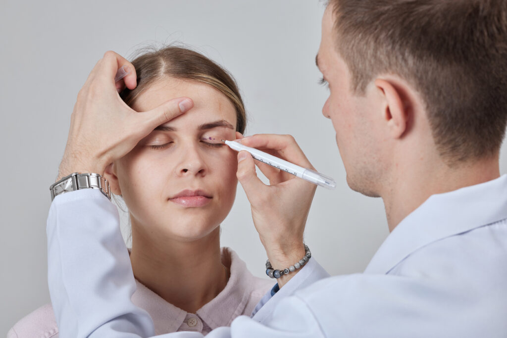 Conheça os principais tratamentos que podem substituir a blefaroplastia para rejuvenescer o olhar sem cirurgia. Quando buscar alternativas à blefaroplastia A blefaroplastia é uma cirurgia muito eficaz para remover o excesso de pele e bolsas ao redor dos olhos, mas nem todos os pacientes desejam passar por um procedimento cirúrgico. Nesses casos, é possível considerar opções menos invasivas que oferecem melhora estética, mesmo que com resultados mais sutis e temporários. As alternativas à blefaroplastia são indicadas principalmente para quem tem sinais iniciais de envelhecimento ou deseja adiar a cirurgia por algum motivo. O avanço da tecnologia estética tem permitido o desenvolvimento de diversos tratamentos que atuam diretamente na firmeza da pele, suavização de rugas e redução de inchaço. Embora essas opções não substituam completamente a cirurgia nos casos mais severos, elas são eficazes para rejuvenescer o olhar de maneira natural e progressiva. Antes de optar por qualquer procedimento, é fundamental passar por uma avaliação com um especialista, que indicará o melhor tratamento conforme as características da pele, grau de flacidez e objetivos do paciente. Principais tratamentos que substituem a blefaroplastia Entre os tratamentos mais utilizados como substitutos da blefaroplastia estão os procedimentos que estimulam colágeno, retraem a pele ou reduzem o volume de gordura ao redor dos olhos. O ultrassom microfocado, por exemplo, é uma excelente opção para quem busca firmeza na região das pálpebras sem cortes. Ele atua nas camadas mais profundas da pele, promovendo um efeito lifting gradual. Outra alternativa eficaz é o laser fracionado, que melhora a textura e a elasticidade da pele ao estimular a regeneração celular. Com sessões periódicas, é possível perceber uma melhora significativa nas linhas finas e na aparência de cansaço ao redor dos olhos. A radiofrequência com microagulhamento também tem se destacado como alternativa à blefaroplastia. A técnica combina estímulo térmico com perfurações controladas que ativam a produção de colágeno. Os resultados aparecem após algumas semanas e continuam evoluindo com o tempo. Preenchimentos com ácido hialurônico são indicados para suavizar o sulco lacrimal e corrigir a perda de volume na região inferior dos olhos. Apesar de não remover pele, o preenchimento melhora o contorno facial e disfarça olheiras profundas, conferindo um aspecto mais descansado. Cuidados, limitações e manutenção dos resultados É importante ressaltar que as alternativas à blefaroplastia não eliminam o excesso de pele, especialmente nos casos de flacidez avançada. Elas oferecem bons resultados em pacientes com sinais leves a moderados, e que desejam evitar o tempo de recuperação de uma cirurgia. A durabilidade desses tratamentos também costuma ser menor que a da cirurgia. Procedimentos como laser, preenchimento ou ultrassom exigem manutenção com sessões regulares para preservar os efeitos ao longo do tempo. Ainda assim, são soluções viáveis para quem busca intervenções mais suaves. Outro ponto importante é a escolha do profissional que irá realizar o procedimento. Mesmo que minimamente invasivos, esses tratamentos precisam ser aplicados com precisão e conhecimento técnico. A Clínica Infinity, localizada em Moema, conta com equipe especializada em rejuvenescimento facial, garantindo segurança e resultados naturais em todas as abordagens. Além dos procedimentos, hábitos saudáveis como alimentação balanceada, hidratação, uso diário de protetor solar e controle do estresse são fundamentais para manter a pele jovem por mais tempo. Cremes com ativos como retinol, cafeína e vitamina C também podem ser indicados para potencializar os resultados. Quando a cirurgia ainda é a melhor opção Embora existam boas alternativas, a blefaroplastia ainda é a solução mais indicada nos casos em que há excesso de pele significativo, bolsas de gordura evidentes ou queda estrutural das pálpebras. Esses fatores não são resolvidos completamente com procedimentos não cirúrgicos. Em pacientes que apresentam desconforto funcional, como dificuldade para abrir os olhos ou visão prejudicada por causa da flacidez, a cirurgia é necessária e oferece resultados mais completos e duradouros. A decisão deve ser feita em conjunto com o cirurgião plástico, levando em consideração o grau de envelhecimento e os objetivos do paciente. A combinação entre procedimentos não cirúrgicos e cirúrgicos também é possível. Muitos pacientes realizam uma blefaroplastia e, posteriormente, mantêm os resultados com sessões periódicas de laser ou radiofrequência. 5 itens de destaque: • Ultrassom microfocado e radiofrequência estimulam firmeza da pele sem cortes • Preenchimento com ácido hialurônico suaviza olheiras e dá volume à região dos olhos • Laser fracionado melhora textura e elasticidade da pele com sessões periódicas • Alternativas à blefaroplastia são ideais para casos leves a moderados de flacidez • A Clínica Infinity oferece avaliação completa para definir o melhor tratamento facial Quem somos? https://www.clinicainfinitypaulista.com.br/quem-somos/ alternativas à blefaroplastia