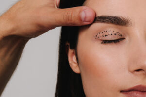 A blefaroplastia rejuvenesce