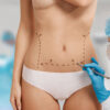 Lipoescultura HD + Vibrolipo