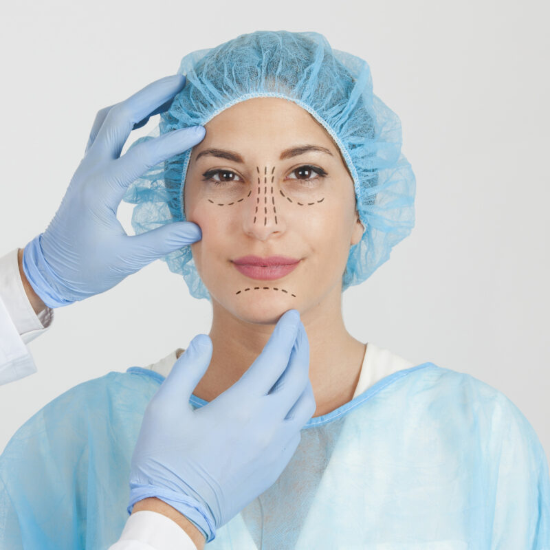 Ritidoplastia com Blefaroplastia